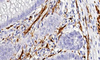 S100 Antibody Reagent（immunohistochemistry）