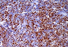 Cyclin D1 Protein ProteinAntibody Reagent(Immunohistochemistry)