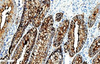 Carcinoembryonic Antigen(CEA) Antibody Reagent(Immunohistochemistry)