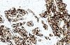 Cytokeratin (Broad Spectrum)Antibody Reagent(Immunohistochemistry)